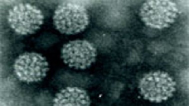 Elektronenmikroskopische Aufnahme von Papillomavirus-Partikeln.