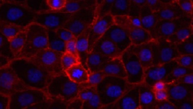 Zellrasen mit DAPI-Färbung des Zellkerns und rot fluoreszierender Zellmembran.